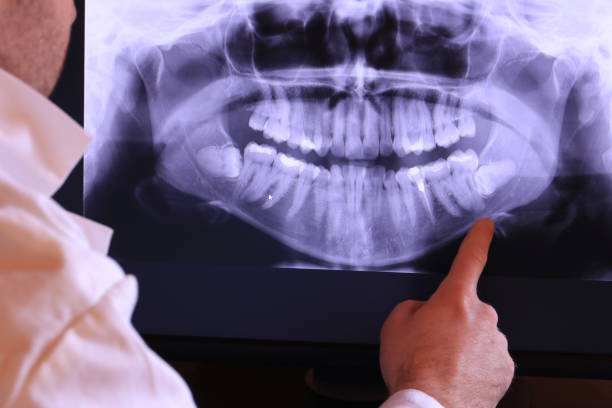 Best Emergency Gum Treatment in Coral Springs, FL